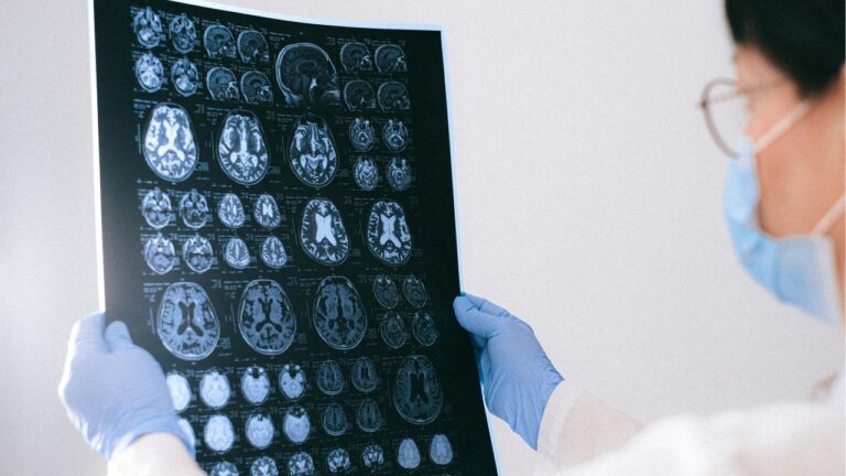 Brain Imaging Research