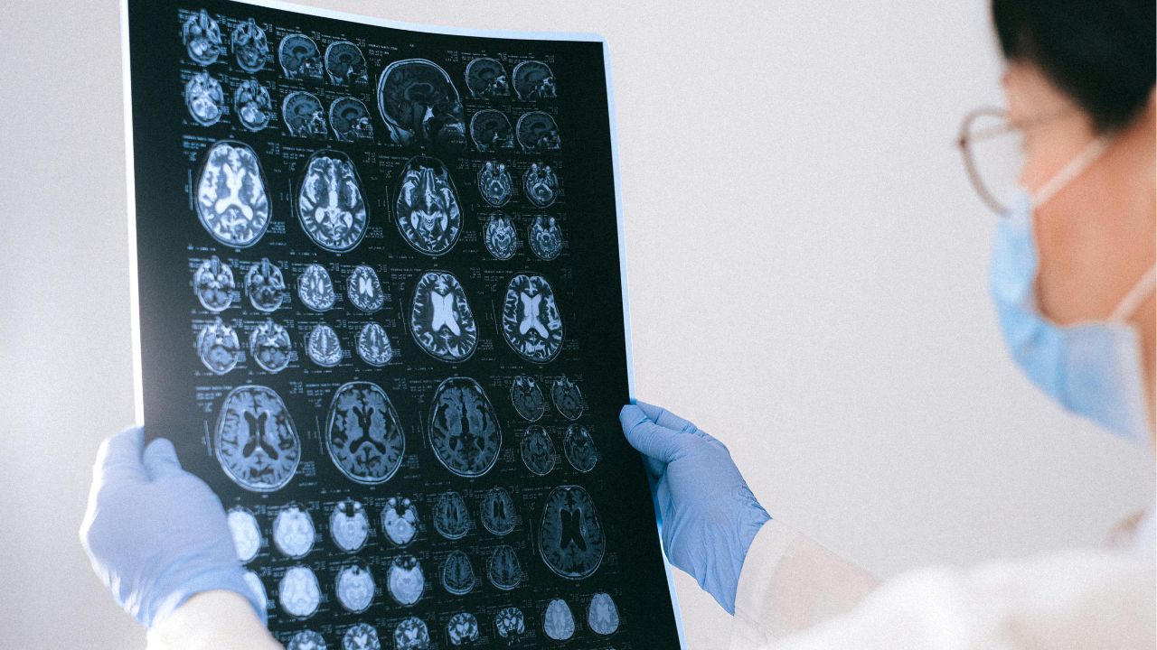 Brain Imaging Research