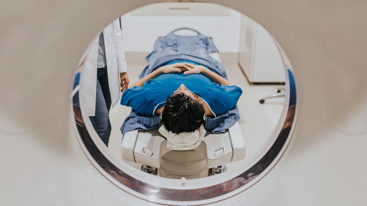 MRI Is Transforming Brain Research